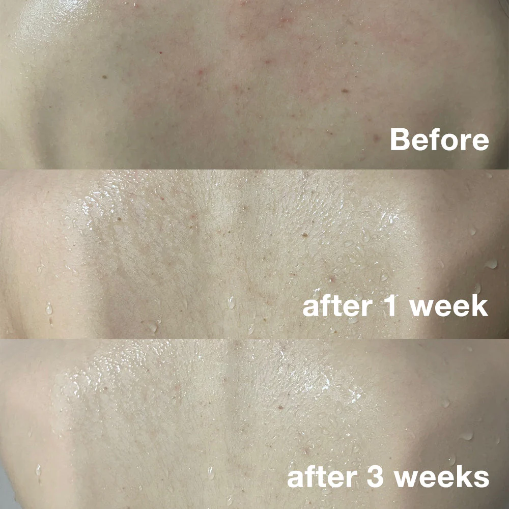 [GIFT] Red Body Wash - Image 9