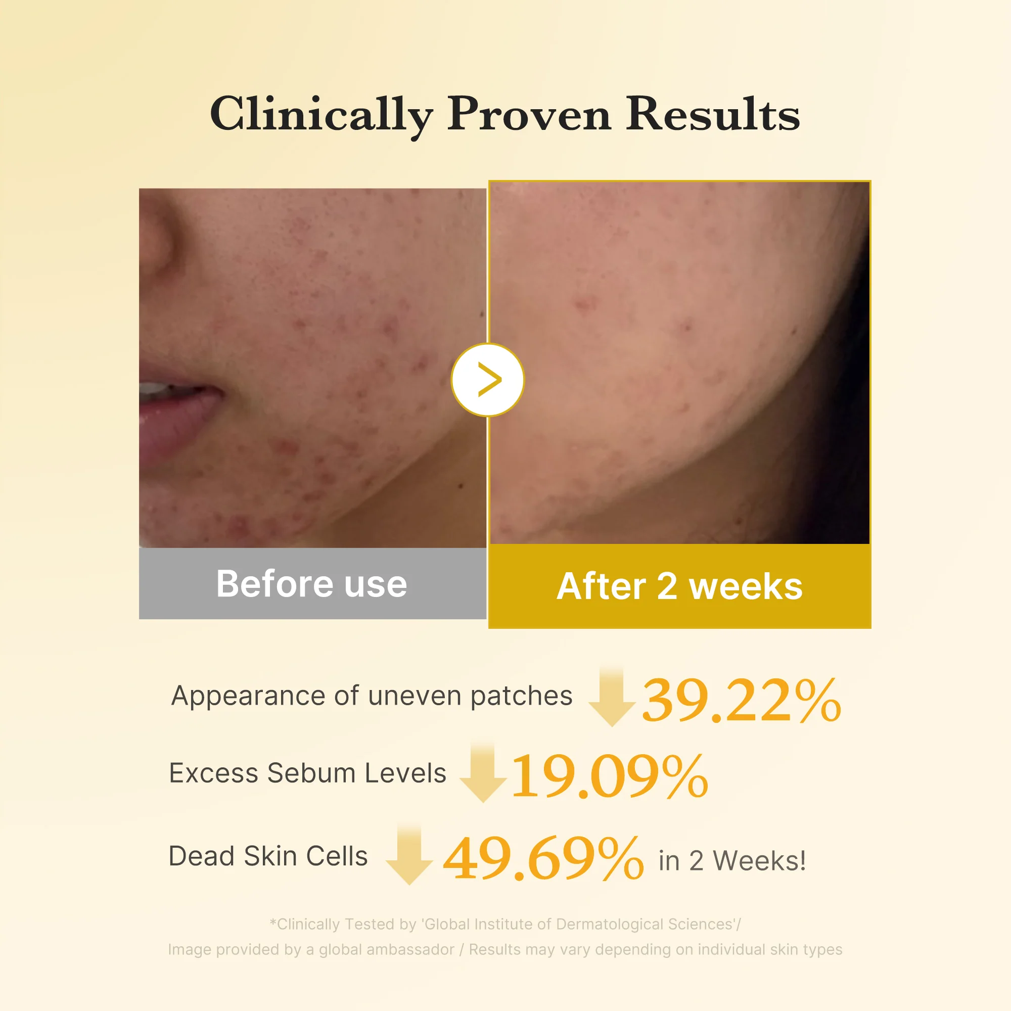 [Subscr.] Kojic Acid Tumeric Toner Pad - Image 4