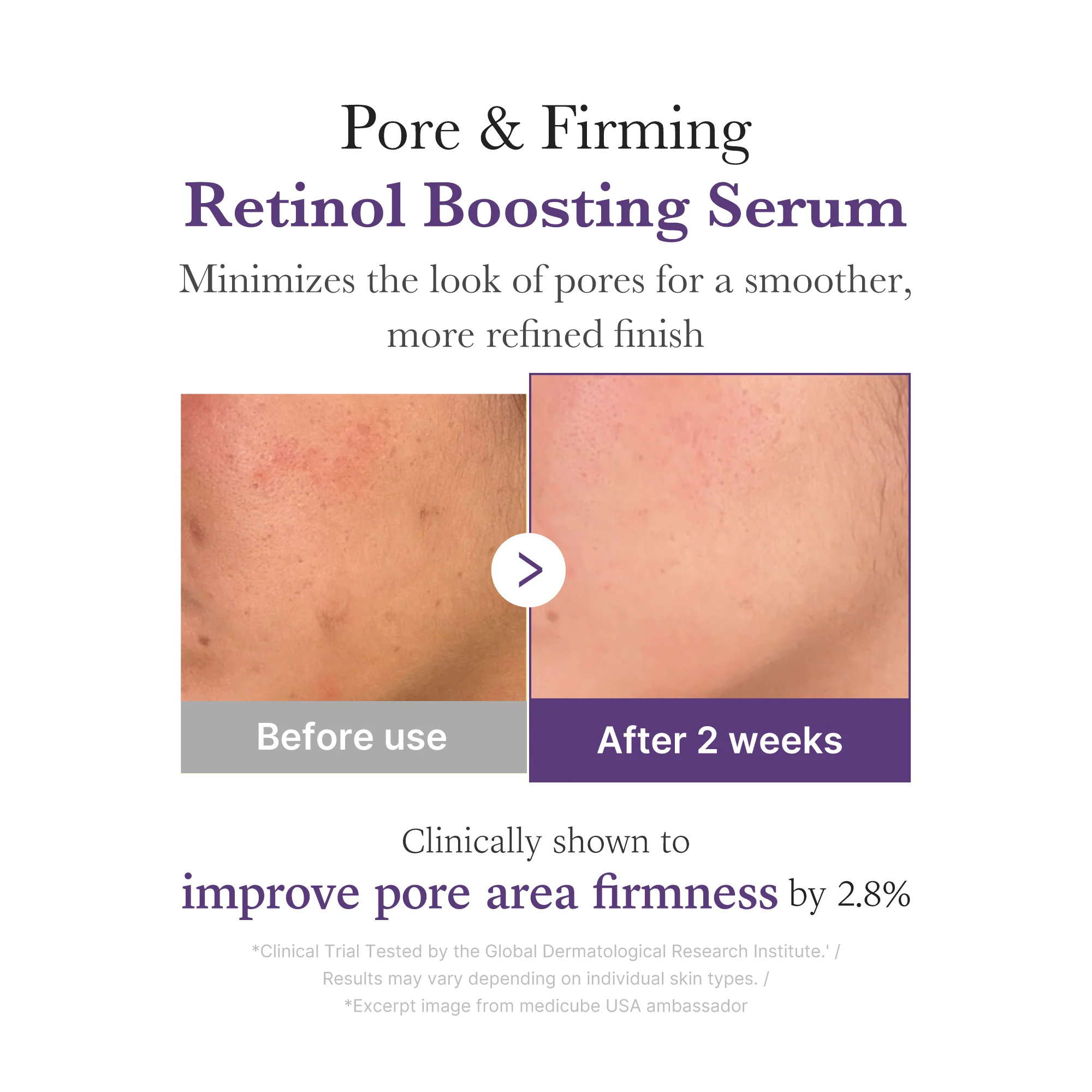 [GIFT] Retinol NMN Boosting Serum - Image 4